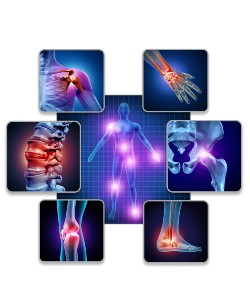 Radiofrequency Ablation (RFA) of Medial Branch Nerves at Advanced Spine Care & Pain Management in Staten Island, NY