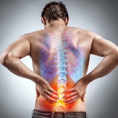 Sciatica Treatment Near Me in Staten Island, NY