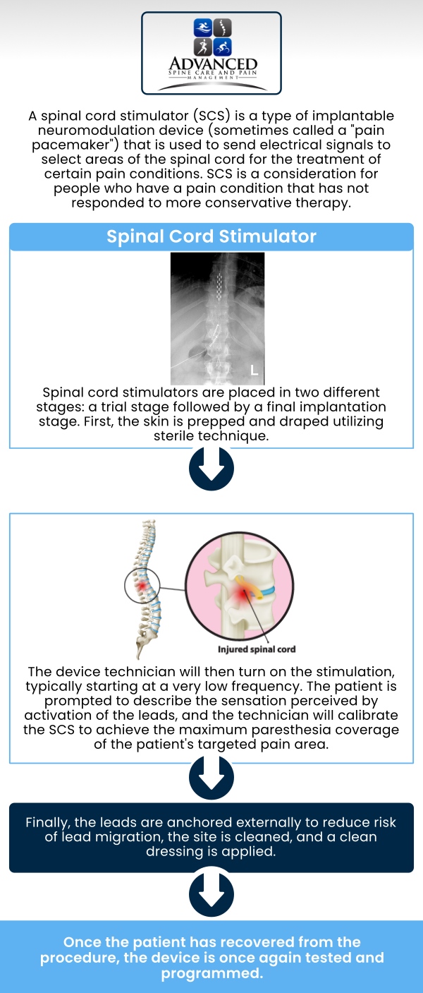 At Advanced Spine Care & Pain Management in Staten Island, NY, Dr. Shailesh S. Pathare, MD, provides professional care using spinal cord stimulators to relieve chronic back and nerve pain. Our team focuses on thorough evaluations, personalized treatment plans, and ongoing support to improve mobility, comfort, and overall quality of life for each patient. For more information, please contact us or book an appointment online. Our clinic are conveniently located in 565 Jewett Avenue Staten Island, NY 10302.