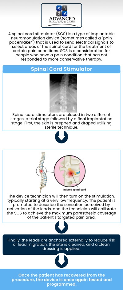 At Advanced Spine Care & Pain Management in Staten Island, NY, Dr. Shailesh S. Pathare, MD, provides professional care using spinal cord stimulators to relieve chronic back and nerve pain. Our team focuses on thorough evaluations, personalized treatment plans, and ongoing support to improve mobility, comfort, and overall quality of life for each patient. For more information, please contact us or book an appointment online. Our clinic are conveniently located in 565 Jewett Avenue Staten Island, NY 10302.